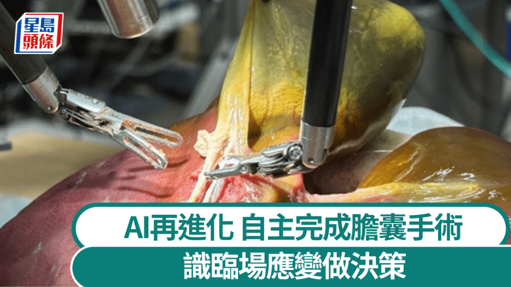 AI做手術｜機器人首度「自主執刀」切膽囊，準確率100％識應變。 約翰霍普金斯大學