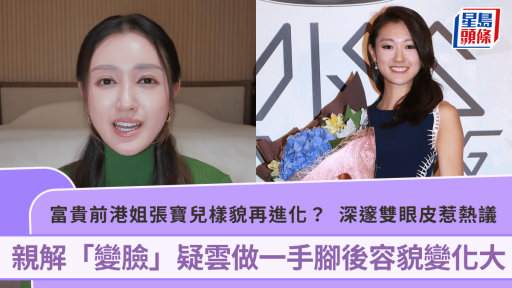富貴前港姐張寶兒樣貌再進化？深邃雙眼皮惹熱議  親解「變臉」疑雲做一手腳後容貌變化大