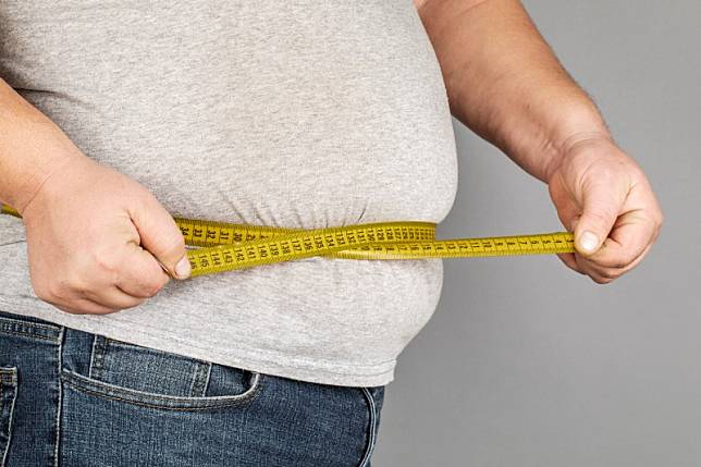肥胖症患者易出現三高。資料圖片