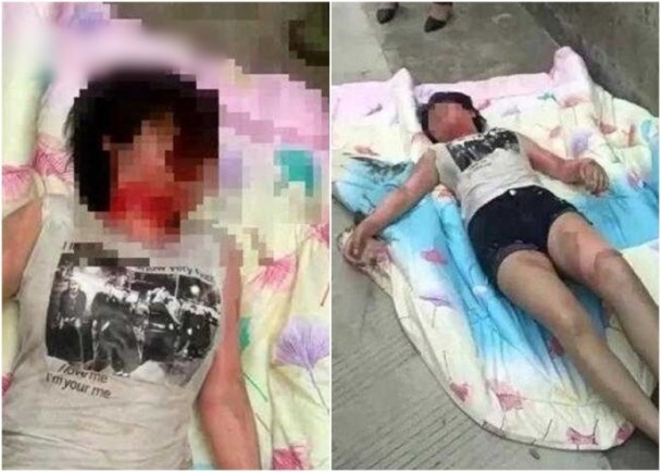 吳女頸部明顯紅了,腿部有大範圍燙傷。(網圖)