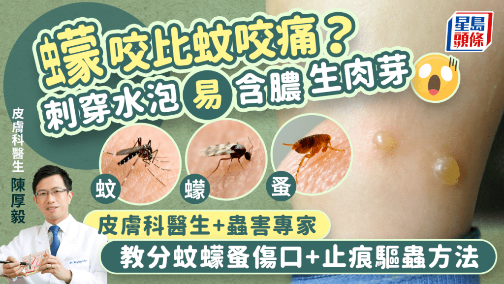 蚊叮蟲咬｜蠓咬比蚊咬痛？男生流膿生肉芽！專家教分蚊蠓蚤+止痕驅蟲方法