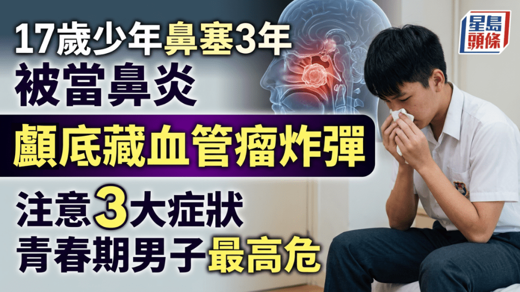 17岁少年鼻塞3年被当鼻炎 颅底竟藏血管瘤炸弹 3症状持续3个月即求医青春期男子最高危