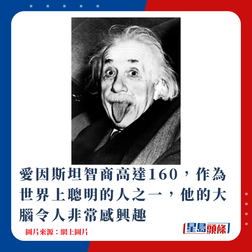 愛因斯坦智商高達160，作為世界上聰明的人之一，他的大腦令人非常感興趣