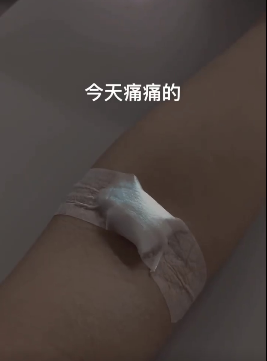 其中一名因此事休學的隊員公開當時被抽血的影像記錄。 Threads @t__156__ 其中一名因此事休學的隊員公開當時被抽血的影像記錄。 Threads @t__156__