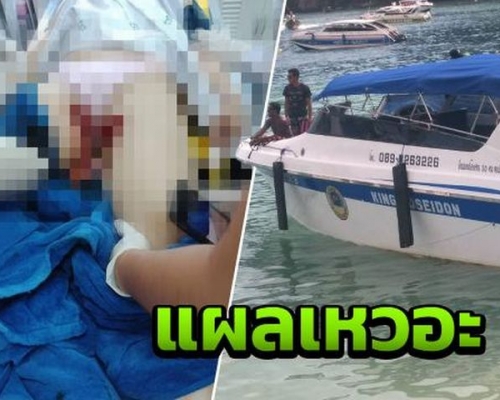 一名39歲中國女遊客上周六在泰國PP島附近的Pilae海灣旅玩時,從船尾下水後,被船槳割傷。網圖