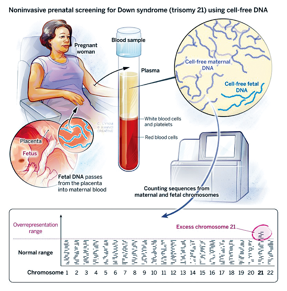 盧煜明於2022年奪得拉斯克獎。圖為有關他發現母血中的胎兒DNA,從而實現唐氏症的非侵入性產前檢測。