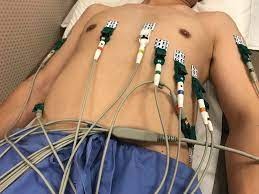 一名病人正在接受心脏科检查。网图