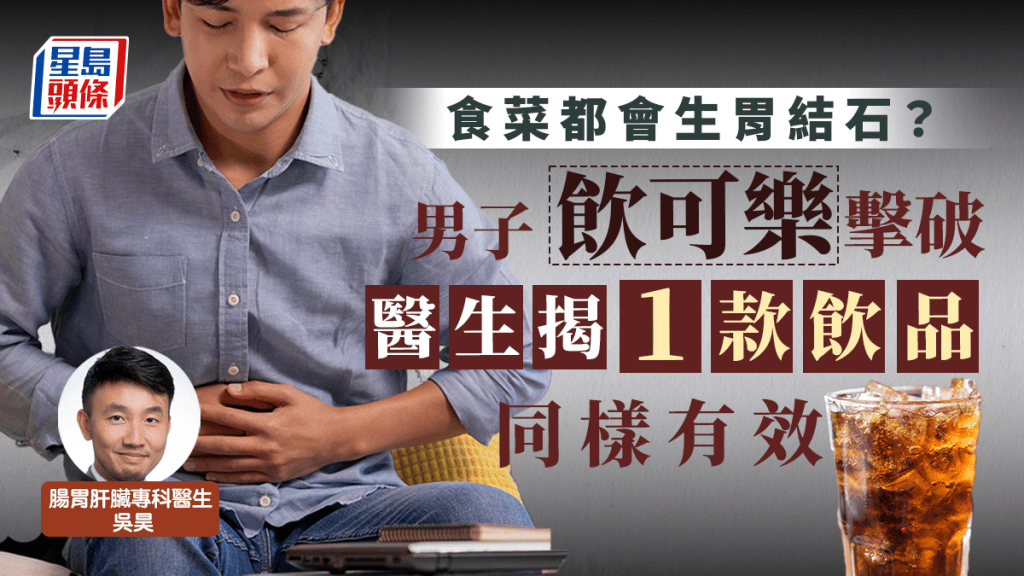 男子生胃結石後竟靠飲可樂康復。