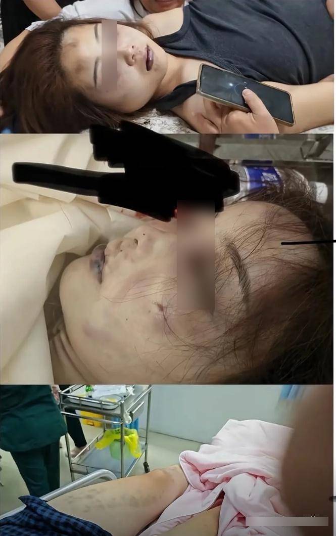 刘铭瑶被丈夫金昊残忍殴毙。