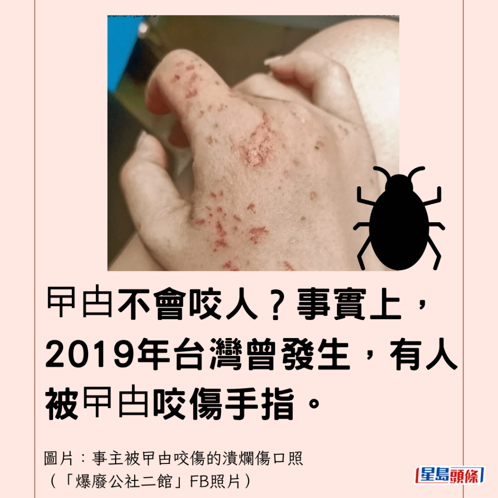 曱甴不會咬人？事實上，2019年台灣曾發生，有人被曱甴咬傷手指。(事主被曱甴咬傷的潰爛傷口照（「爆廢公社二館」FB照片）)