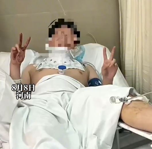 曹先生夢遊時由3樓墜下多處骨折。抖音