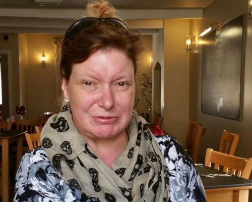 英國婦人沃爾沃克(Cate Wallwork)自17歲起無笑過。網上圖片