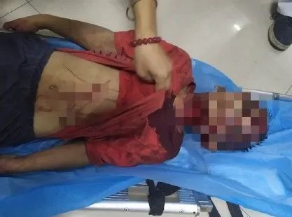 男童被擄走並毆打近兩小時。網圖