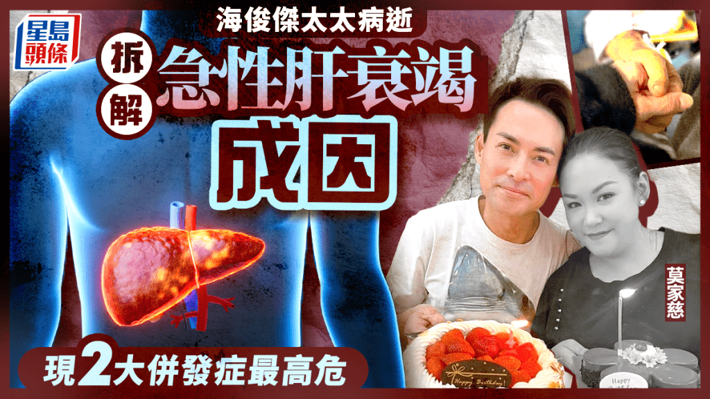 海俊傑太太離世｜拆解急性肝衰竭6大成因 4周內致嚴重肝損傷 現2大併發症最高危
