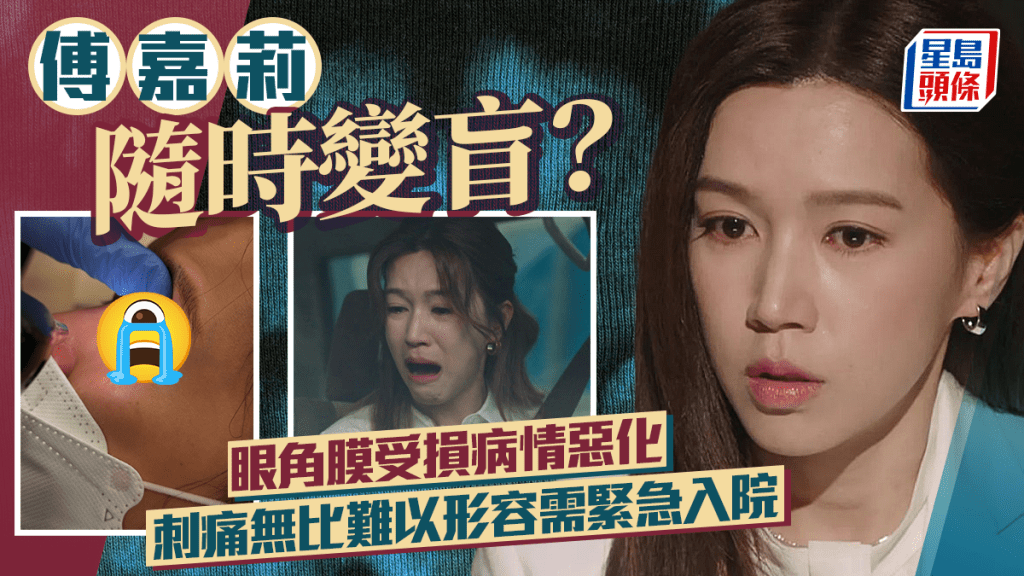 傅嘉莉隨時變盲?眼角膜受損病情惡化爆發式爆紅筋 刺痛無比難以形容需緊急入院