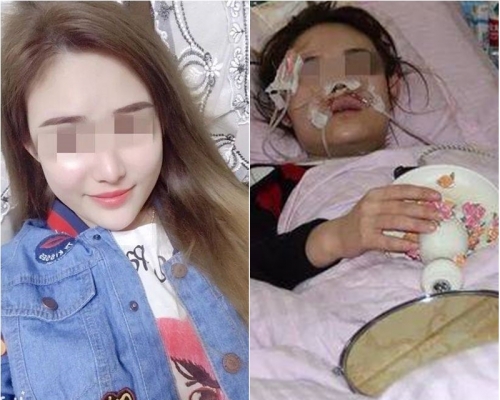天津25歲女子摸流浪狗慘遭咬臉 。網上圖片
