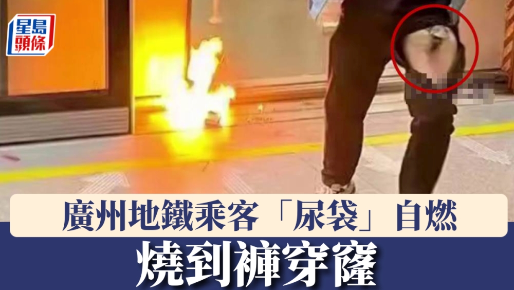 廣州地鐵烈士陵園站23日發生「尿袋」自燃事件，乘客燒到褲「穿窿」。