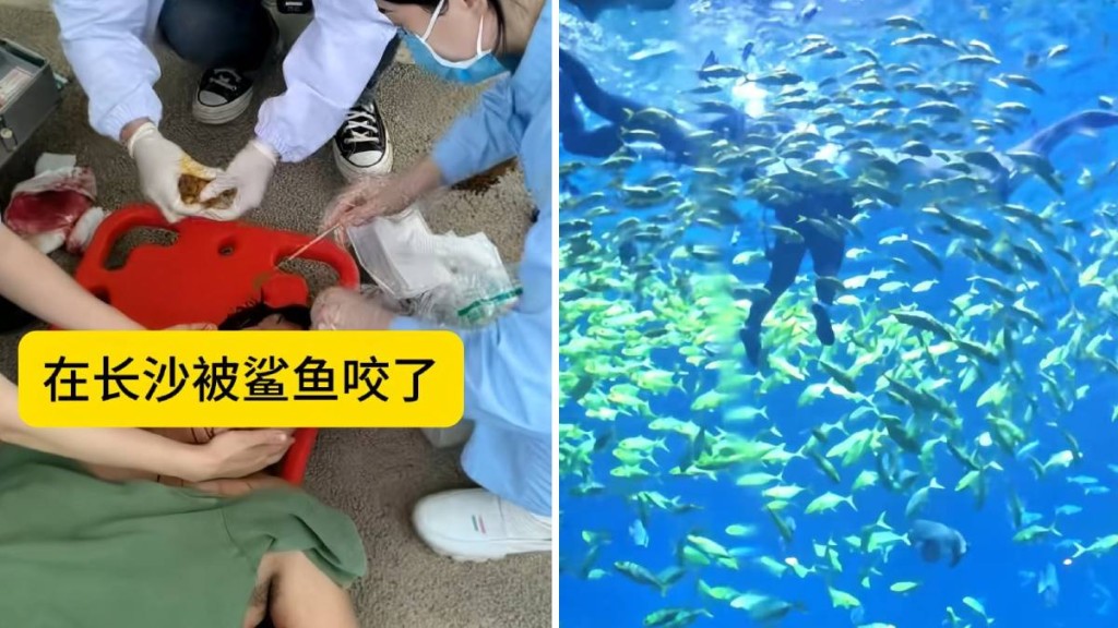 包先生參加水族館的潛水活動時被鯊魚咬至毀容。抖音