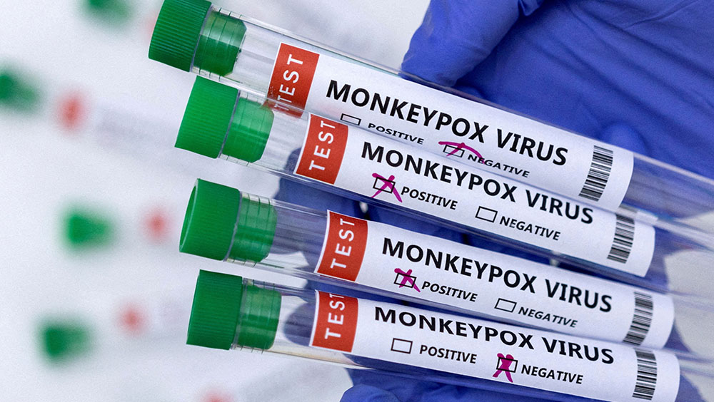 美國疾控及預防中心表示有證據顯示猴痘出現本地傳播。路透社圖片
