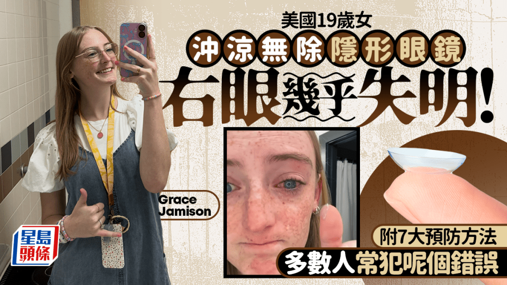 美國19歲女沖涼無除隱形眼鏡右眼幾乎失明！附7大預防方法 多數人常犯一個錯誤