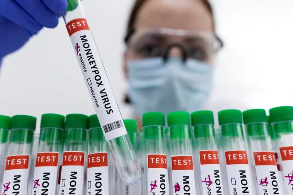 丹麥疫苗製造商正投入生產更多天花疫苗。路透