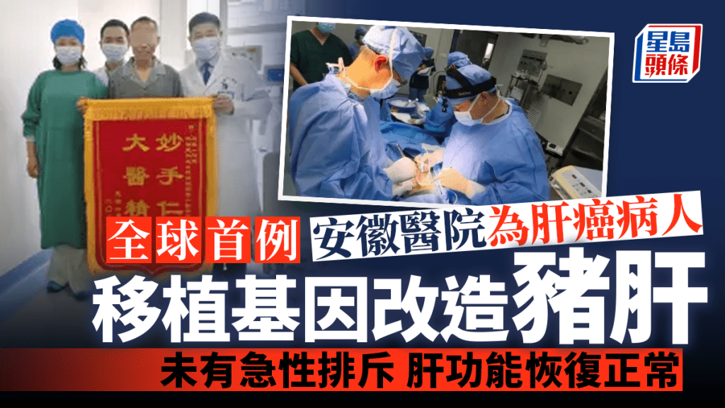 豬至人的異種肝移植臨床手術在安徽完成。