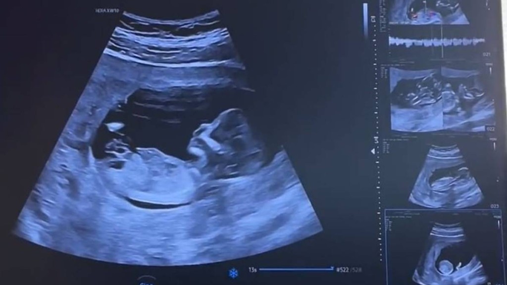 內地多地提高女職工產檢報銷水平。小紅書