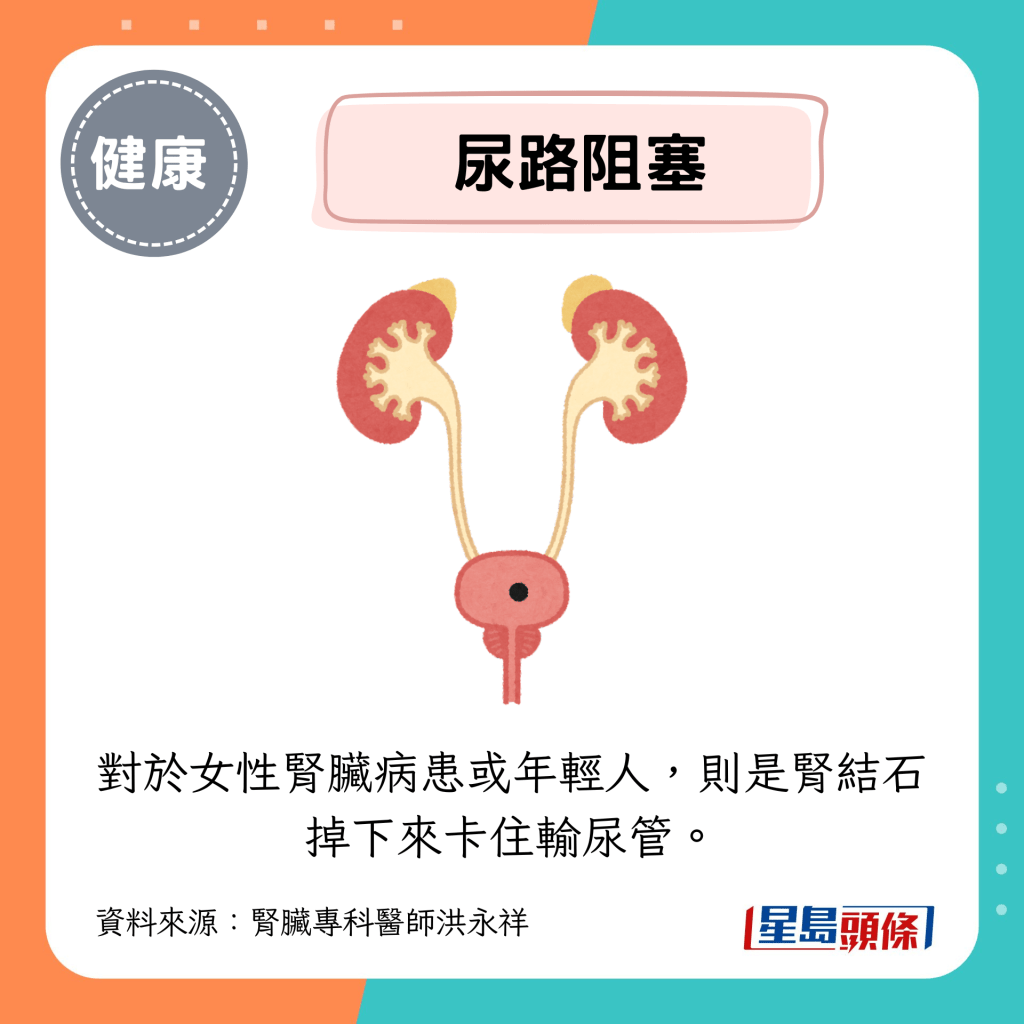 对于女性肾脏病患或年轻人,则是肾结石掉下来卡住输尿管。 对于女性肾脏病患或年轻人,则是肾结石掉下来卡住输尿管。