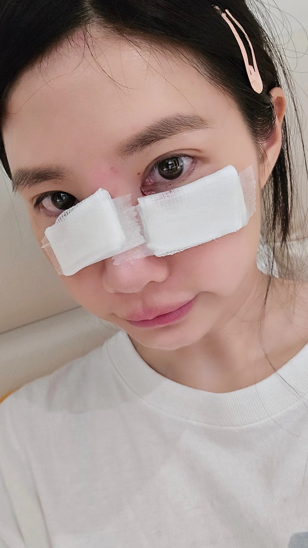 筠熹差點傷到眼睛。 筠熹差點傷到眼睛。