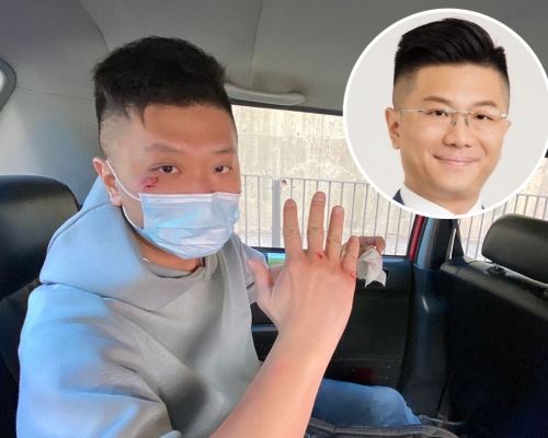 灣仔區議會副主席林偉文擺街站時發生意外受傷。