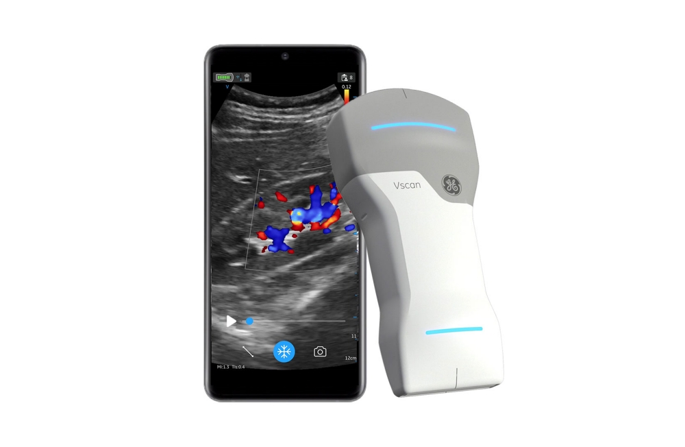 手提式无线超声波扫描仪 Vscan Air，以蓝牙与手机配对使用，像图更清晰，体积更小巧，亦更省电，现时在医疗行业热卖。
