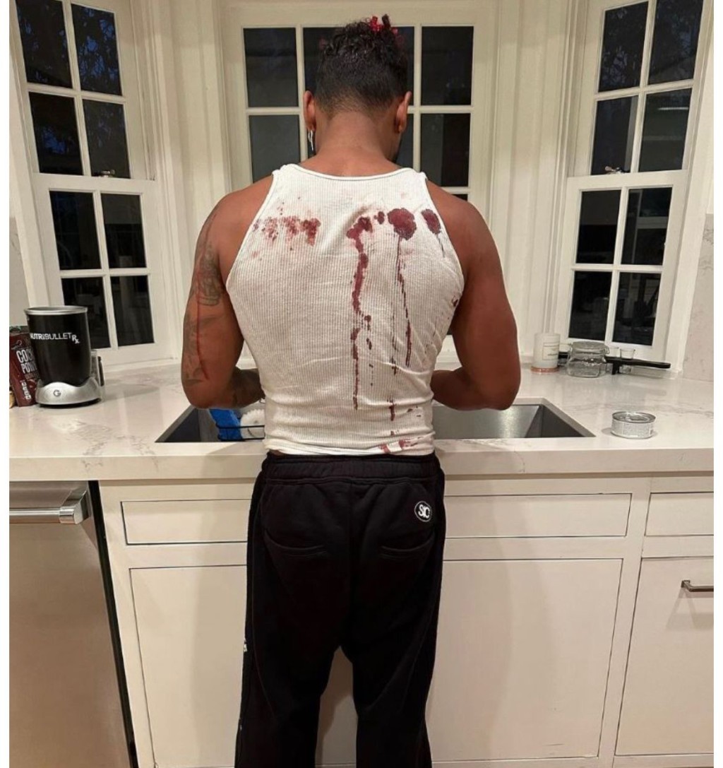 Miguel演出後展示背部流血傷勢。
