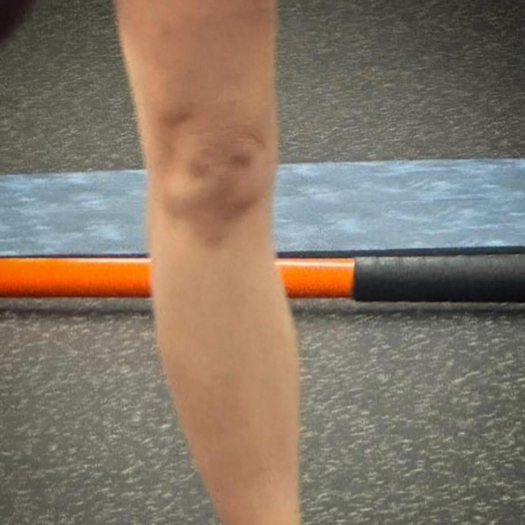 小儀在社交網貼上堂做運動期間，從鏡中驚見膝頭哥出現一隻伸脷狗仔的摺紋，與已離世的DeeDee相似度極高。