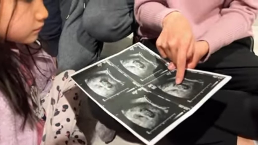 鍾嘉欣拎住胎兒嘅超聲波相片，向仔女講解。