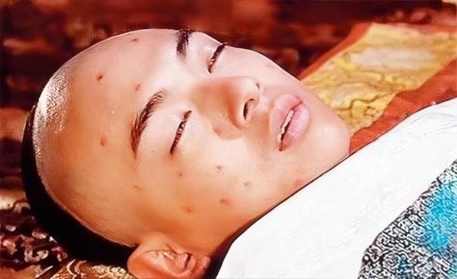 清同治帝被傳嫖妓染梅毒,19歲便駕崩。影視劇照 清同治帝被傳嫖妓染梅毒,19歲便駕崩。影視劇照