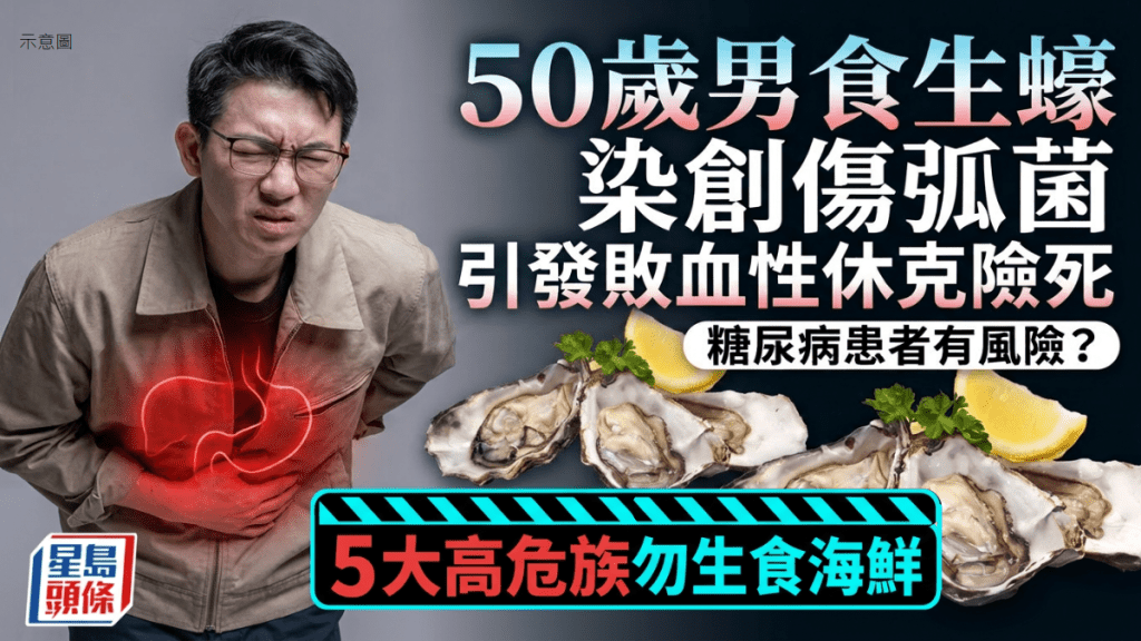 50歲男食生蠔患敗血性休克入ICU 揭染創傷弧菌 專家點名高危族勿生食海鮮