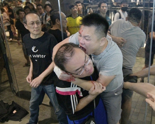 趙家賢遭人咬甩左耳。資料圖片