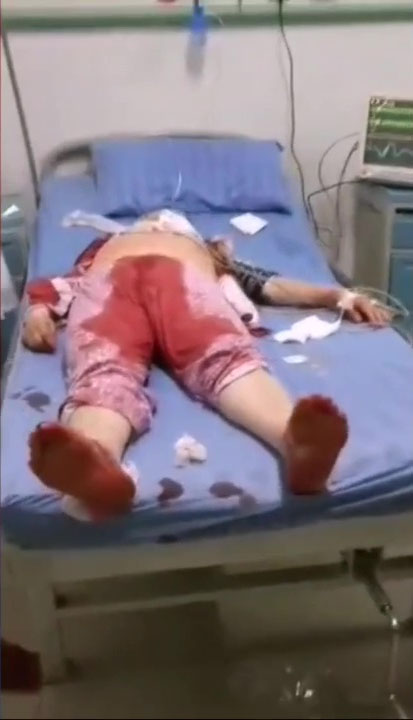 傷者滿身是血。（網圖）