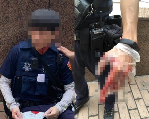 2名警員分別頸部及手部受傷。網上圖片