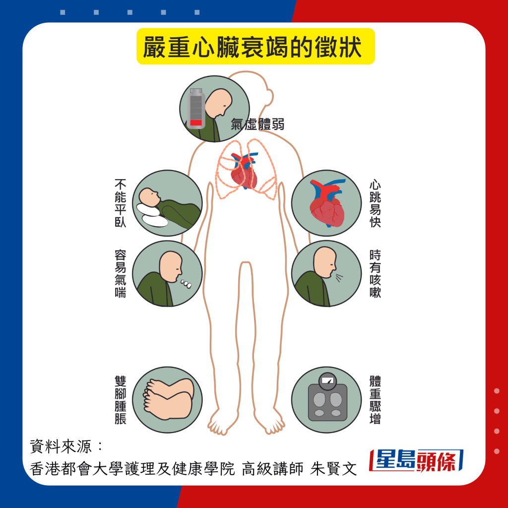 嚴重心臟衰竭的症狀