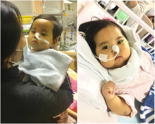 女嬰小予恩去年12月在瑪麗醫院接受肝腸脗合手術後,心跳一度停頓6分鐘。資料圖片