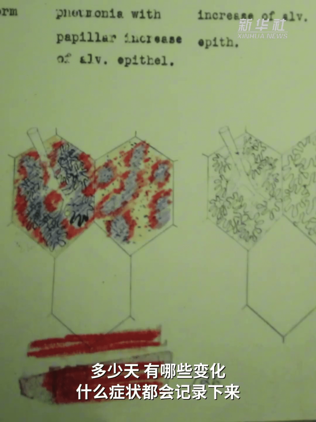 前七三一部隊成員親述細菌戰罪行。 前七三一部隊成員親述細菌戰罪行。