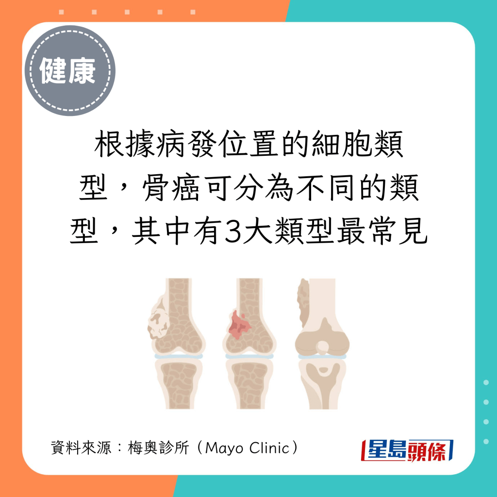 根据病发位置的细胞类型，骨癌可分为不同的类型，其中有3大类型最常见