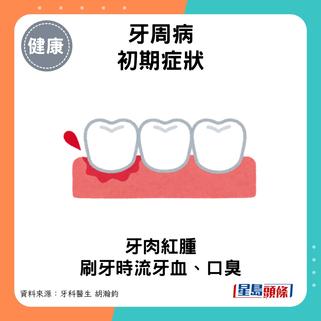 牙周病初期症状：流牙血。