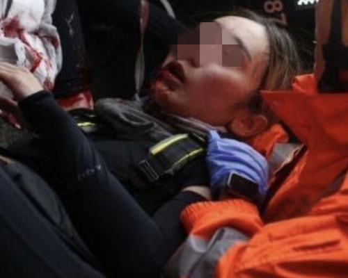 有消息稱，醫療報告顯示「爆眼女子」的右眼球根本並無受傷爆裂。網圖