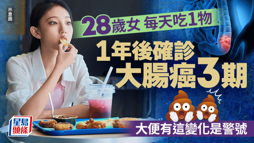 28歲女每天吃1物 1年後確診大腸癌3期 大便出現這變化恐中招