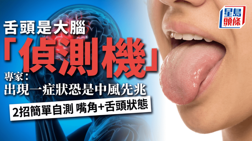 舌頭是大腦「偵測機」出現一症狀恐是中風先兆 2招簡單自測嘴角、舌頭狀態