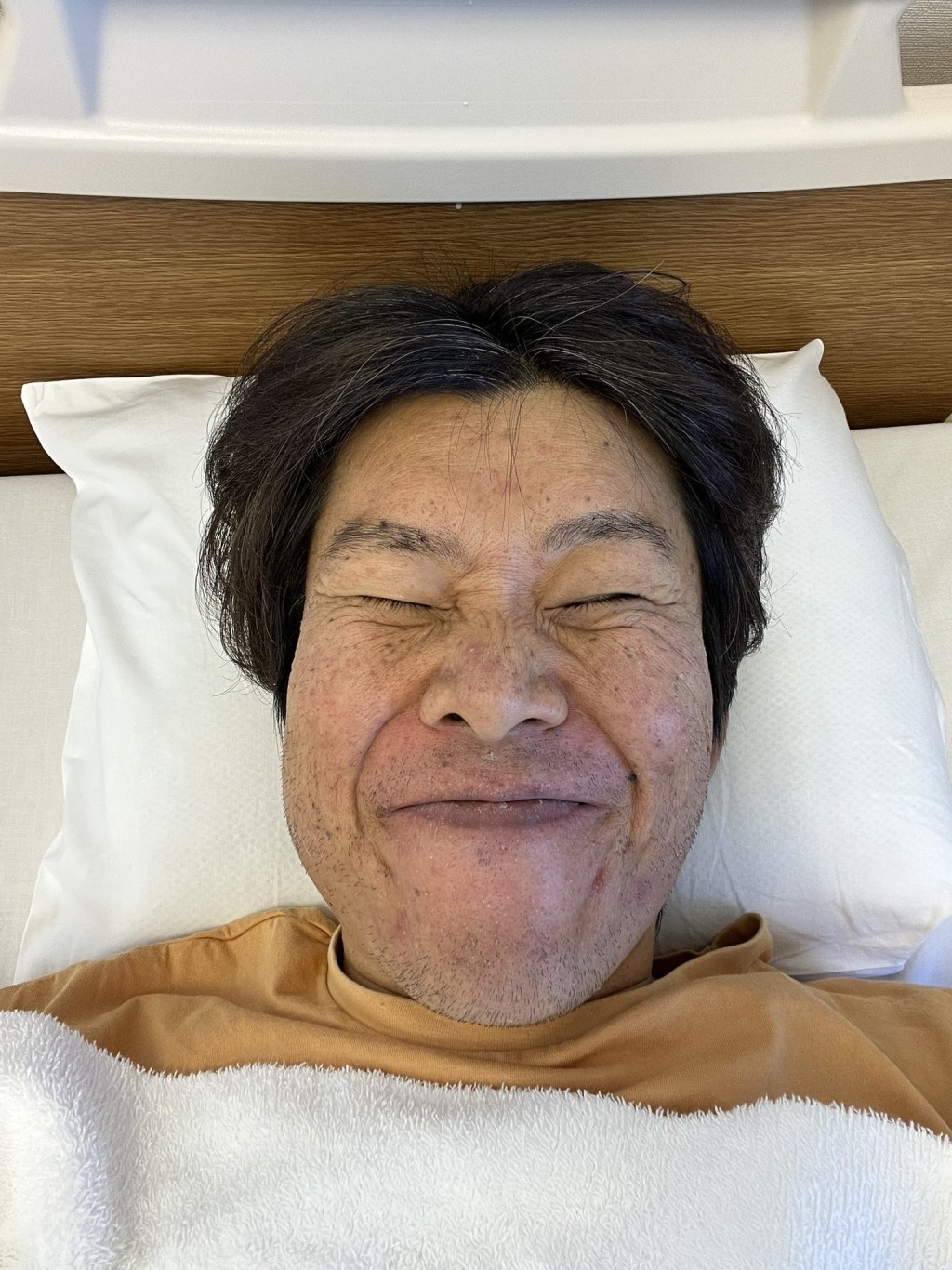日本網紅Kimbae將多年來治療的經過放上網。