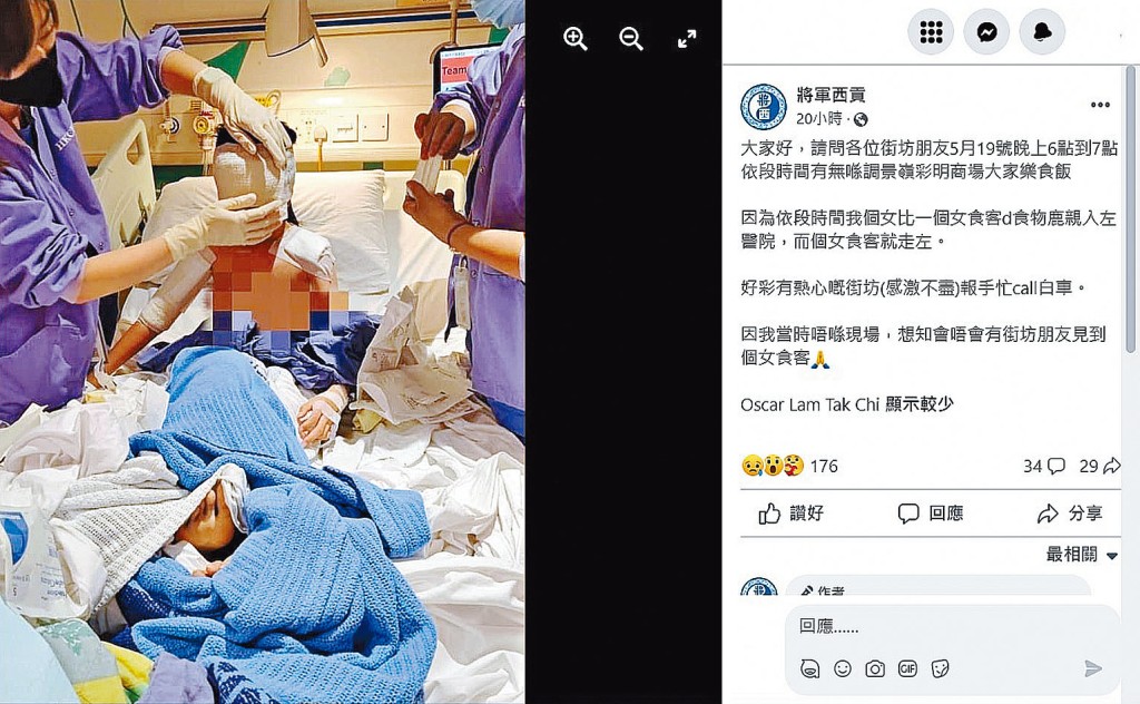 受傷女童的面頰、整片前額及手臂遭到二級燙傷。