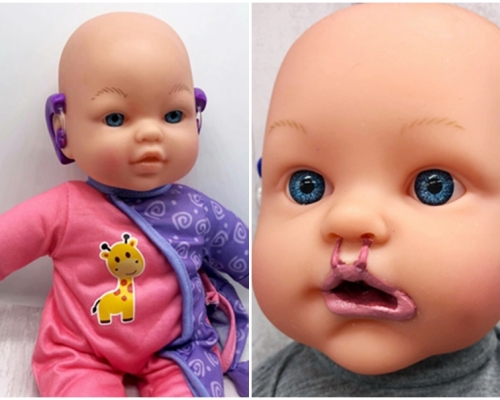 英國一名媽媽Clare Tawell在2017年開設了專門訂製「殘障娃娃」的網店「Bright Ears UK」。網圖